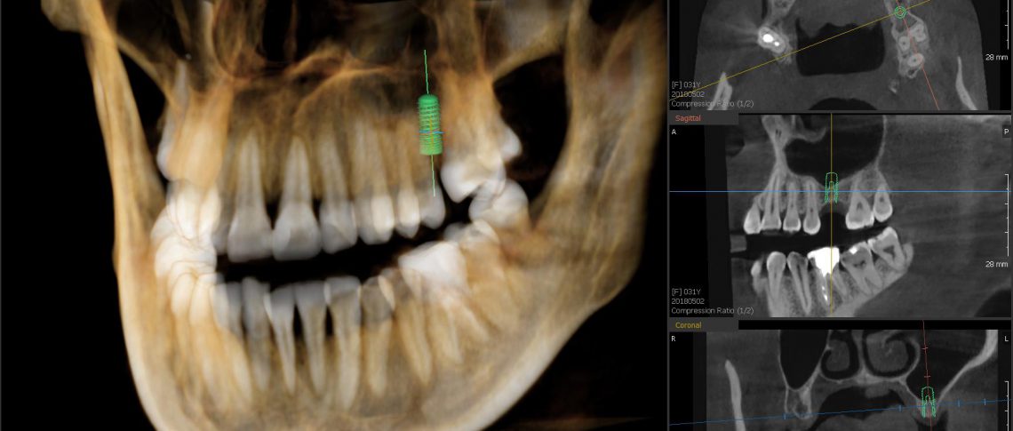Panoramic X-ray and computer tomography – VATECH PaX- i3D Smart